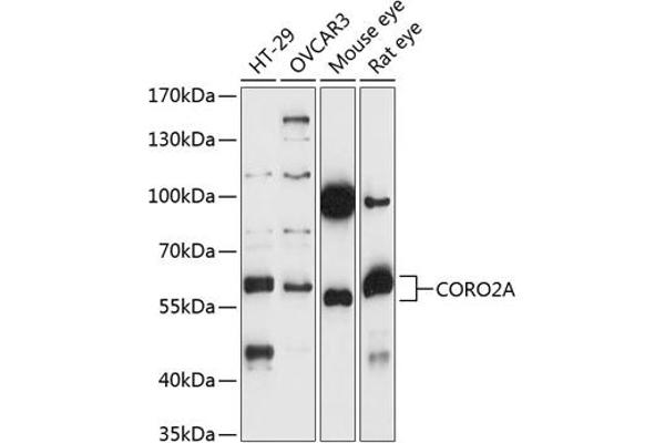 CORO2A antibody  (AA 376-525)