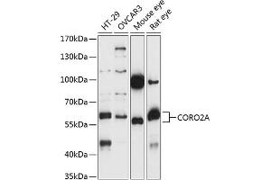 Western blot analysis of extracts of various cell lines, using CORO2A antibody (ABIN7266508) at 1:1000 dilution. (CORO2A antibody  (AA 376-525))
