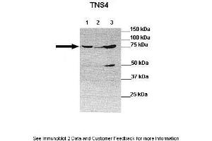 Lanes:  Lane 1: 30ug human 293T lysate Lane 2: 30ug human BEL7402 cell lysate Lane 3: 30ug human SMMC772 lysate  Primary Antibody Dilution:  1:1000 Secondary Antibody:  Anti-rabbit-HRP Anti-rabbit-HRP Secondary Antibody Dilution:  1:10,000 Gene Name:  TNS4 a Submitted by:  Dr Frankie Ko Chi Fat, Lo-Kong Chan, Irene O. (Tensin 4 antibody  (N-Term))