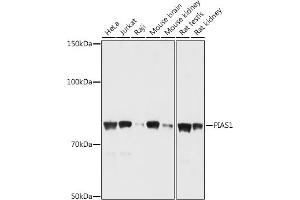 Western blot analysis of extracts of various cell lines, using PI antibody (ABIN6128448, ABIN6145592, ABIN6145594 and ABIN6214191) at 1:1000 dilution. (PIAS1 antibody  (AA 422-651))