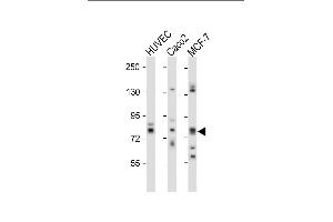 All lanes : Anti-cGKII Antibody (C-term) at 1:1000 dilution Lane 1: HUVEC whole cell lysate Lane 2: Caco2 whole cell lysate Lane 3: MCF-7 whole cell lysate Lysates/proteins at 20 μg per lane. (PRKG2 antibody  (C-Term))