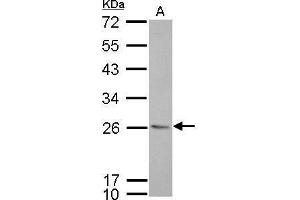 WB Image CD74 antibody [N1N2], N-term detects CD74 protein by Western blot analysis. (CD74 antibody  (N-Term))