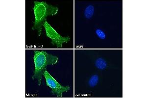 ABIN570923 Immunofluorescence analysis of paraformaldehyde fixed 3T3-L1 cells, permeabilized with 0. (TREM2 antibody  (Internal Region))