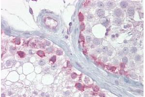 Anti-SYCP1 antibody IHC staining of human testis. (SYCP1 antibody  (AA 72-121))