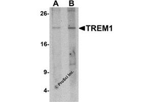 Western Blotting (WB) image for anti-Triggering Receptor Expressed On Myeloid Cells 1 (TREM1) (N-Term) antibody (ABIN1077426) (TREM1 antibody  (N-Term))