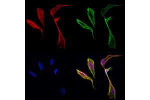 ABIN6257912 and ABIN6274177 staining Hela cells by IF/ICC.