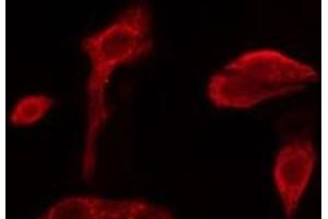 ABIN6279673 staining NIH-3T3 cells by IF/ICC. (PABPC3 antibody)