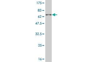 Western Blot detection against Immunogen (57. (DLX3 antibody  (AA 1-287))