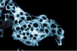 Immunofluorescent staining of HepG2 cells with anti-ALDH. (Aldehyde Dehydrogenase antibody  (AA 7-128))