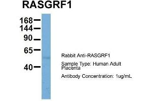 Host: Rabbit  Target Name: RASGRF1  Sample Tissue: Human Adult Placenta  Antibody Dilution: 1.
