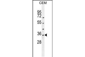 Western blot analysis in CEM cell line lysates (35ug/lane).