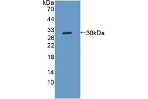 Detection of Recombinant NOTCH2NL, Human using Polyclonal Antibody to Notch2 N-Terminal Like Protein (NOTCH2NL) (NOTCH2NL antibody  (AA 1-236))