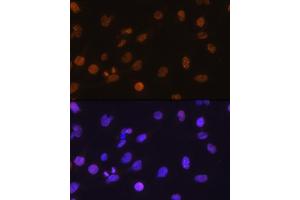 Immunofluorescence analysis of C6 cells using DDIT3/CHOP antibody (ABIN3020709, ABIN3020710, ABIN3020711, ABIN1512759 and ABIN6213685) at dilution of 1:100. (DDIT3 antibody  (C-Term))