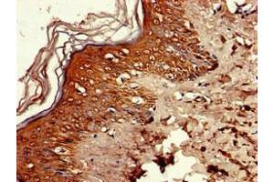 Immunohistochemistry of paraffin-embedded human skin tissue using ABIN7168111 at dilution of 1:100 (RNASEH2C antibody  (AA 1-164))