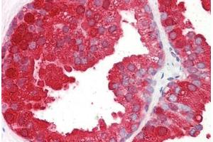 Image no. 2 for anti-Acid Phosphatase, Prostate (ACPP) (AA 269-282) antibody (ABIN1493860) (ACPP antibody  (AA 269-282))