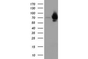 HEK293T cells were transfected with the pCMV6-ENTRY control (Left lane) or pCMV6-ENTRY HSPA6 (Right lane) cDNA for 48 hrs and lysed. (HSPA6 antibody)