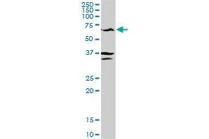GPT MaxPab rabbit polyclonal antibody. (ALT antibody  (AA 1-496))