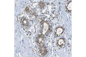 Immunohistochemical staining (Formalin-fixed paraffin-embedded sections) of human breast with BAG1 polyclonal antibody  shows moderate positivity in glandular cells. (BAG1 antibody)