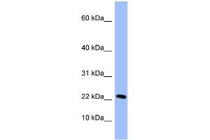 WB Suggested Anti-PIN4  Antibody Titration: 0. (PIN4 antibody  (Middle Region))