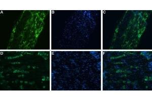 Expression of NaV1. (SCN11A antibody  (C-Term, Intracellular))