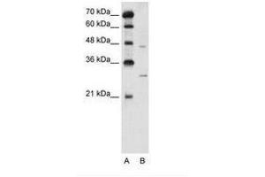 Image no. 2 for anti-Solute Carrier Family 36 (Proton/amino Acid Symporter), Member 3 (SLC36A3) (N-Term) antibody (ABIN205028) (SLC36A3 antibody  (N-Term))