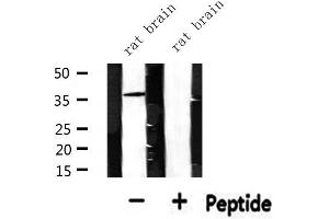 Western blot analysis of extracts from rat brain, using CDKL4 Antibody. (CDKL4 antibody  (Internal Region))
