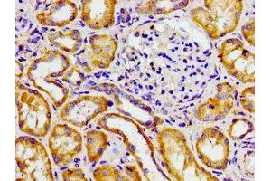 Immunohistochemistry of paraffin-embedded human kidney tissue using ABIN7143334 at dilution of 1:100