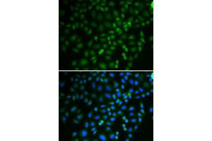 Immunofluorescence analysis of U2OS cells using TRIM21 antibody. (TRIM21 antibody)