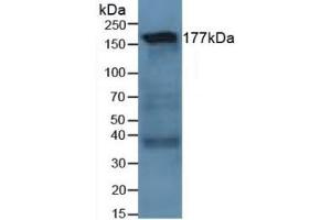 Detection of LAMC1 in Human Lung Tissue using Polyclonal Antibody to Laminin Gamma 1 (LAMC1) (Laminin gamma 1 antibody  (AA 521-772))