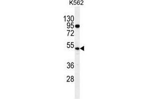 TdT Antibody (C-term) western blot analysis in K562 cell line lysates (35 µg/lane). (TdT antibody  (C-Term))