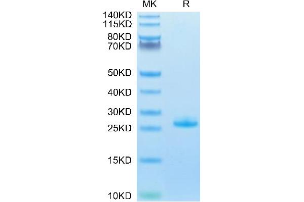 FGF21 Protein (AA 29-209) (His tag)