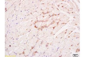 Formalin-fixed and paraffin embedded rat tongue tissue labeled with Anti PHOSPHO-FGFR1 (TYR307) Polyclonal antibody,Unconjugated (ABIN758182) at 1:200 followed by conjugation to the secondary antibody and DAB staining. (FGFR1 antibody  (pTyr307))