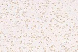 Immunohistochemistry analysis of paraffin-embedded mouse substantia nigra using VPS13B (ABIN7076176) at dilution of 1: 2000 (VPS13B antibody)