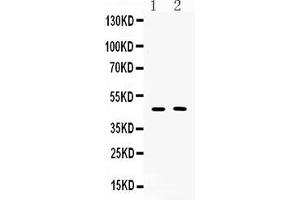 Western blot analysis of SERPINA5 expression in rat liver extract ( Lane 1) and SKOV3 whole cell lysates ( Lane 2). (SERPINA5 antibody  (AA 86-406))