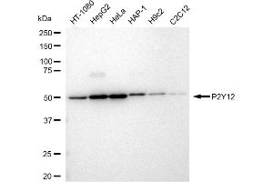 anti-Purinergic Receptor P2Y, G-Protein Coupled, 12 (P2RY12) antibody