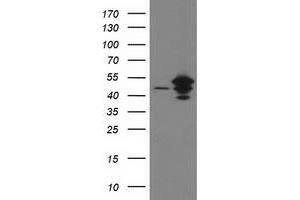 HEK293T cells were transfected with the pCMV6-ENTRY control (Left lane) or pCMV6-ENTRY ARFGAP1 (Right lane) cDNA for 48 hrs and lysed. (ARFGAP1 antibody)