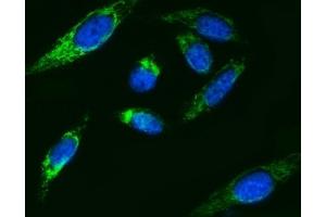 IF analysis of ATP5F1B using anti-ATP5F1B antibody (ABIN7599866). (Atp5f1b (AA 123-529) antibody)
