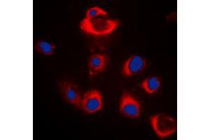 Immunofluorescent analysis of BAX staining in HeLa cells. (BAX antibody  (Center))