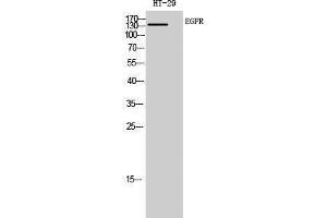 Western Blotting (WB) image for anti-Epidermal Growth Factor Receptor (EGFR) (Ser322), (Ser325) antibody (ABIN3184428) (EGFR antibody  (Ser322, Ser325))