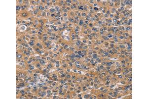 Immunohistochemistry (IHC) image for anti-Natural Cytotoxicity Triggering Receptor 2 (NCR2) antibody (ABIN2432791) (NKp44/NCR2 antibody)