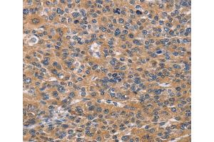 Immunohistochemistry (IHC) image for anti-Natural Cytotoxicity Triggering Receptor 2 (NCR2) antibody (ABIN5549765) (NKp44/NCR2 antibody)