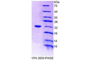 SDS-PAGE (SDS) image for Beta Lactoglobulin (LGB) (AA 19-178) protein (His tag) (ABIN2124129) (Beta Lactoglobulin (LGB) (AA 19-178) protein (His tag))