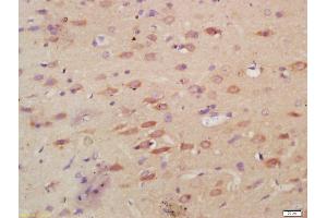 Formalin-fixed and paraffin embedded rat brain labeled with Anti-MPO Polyclonal Antibody, Unconjugated (ABIN1387491) at 1:200, followed by conjugation to the secondary antibody and DAB staining (Myeloperoxidase antibody  (AA 678-745))