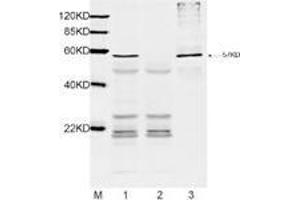 Lane1: 1 µL E-coli lysate with DYKDDDDK-tag protein (MW: 57 kDa) and 2 µg Mouse Anti-DYKDDDDK-tag Monoclonal Antibody (ABIN387700) for IP. (DYKDDDDK Tag antibody)
