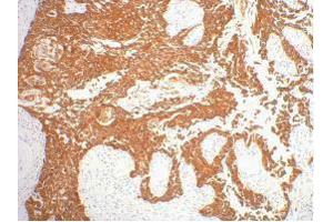 Immunohistochemistry (IHC) image for anti-Keratin 16 (KRT16) antibody (ABIN3178609) (KRT16 antibody)