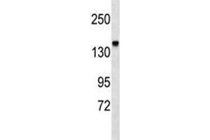 Integrin alpha 2 antibody western blot analysis in mouse kidney tissue lysate (ITGA2 antibody  (AA 1152-1180))
