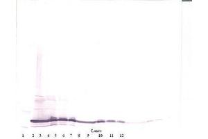 Image no. 2 for anti-Interleukin 17F (IL17F) antibody (ABIN465701)