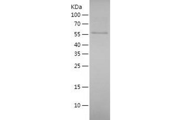 YARS Protein (AA 1-528) (His tag)