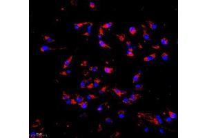 Immunocytochemistry analysis of 4 % paraformaldehyde-fixed HeLa cells using COX5B (ABIN7073665) at dilution of 1: 1000 (200x lens) (COX5B antibody)