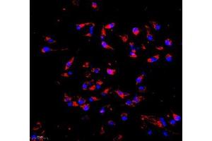 Immunocytochemistry analysis of 4 % paraformaldehyde-fixed HeLa cells using COX5B (ABIN7073665) at dilution of 1: 1000 (200x lens) (COX5B antibody)